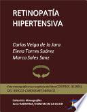 Retinopatía hipertensiva