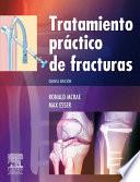 Tratamiento práctico de fracturas